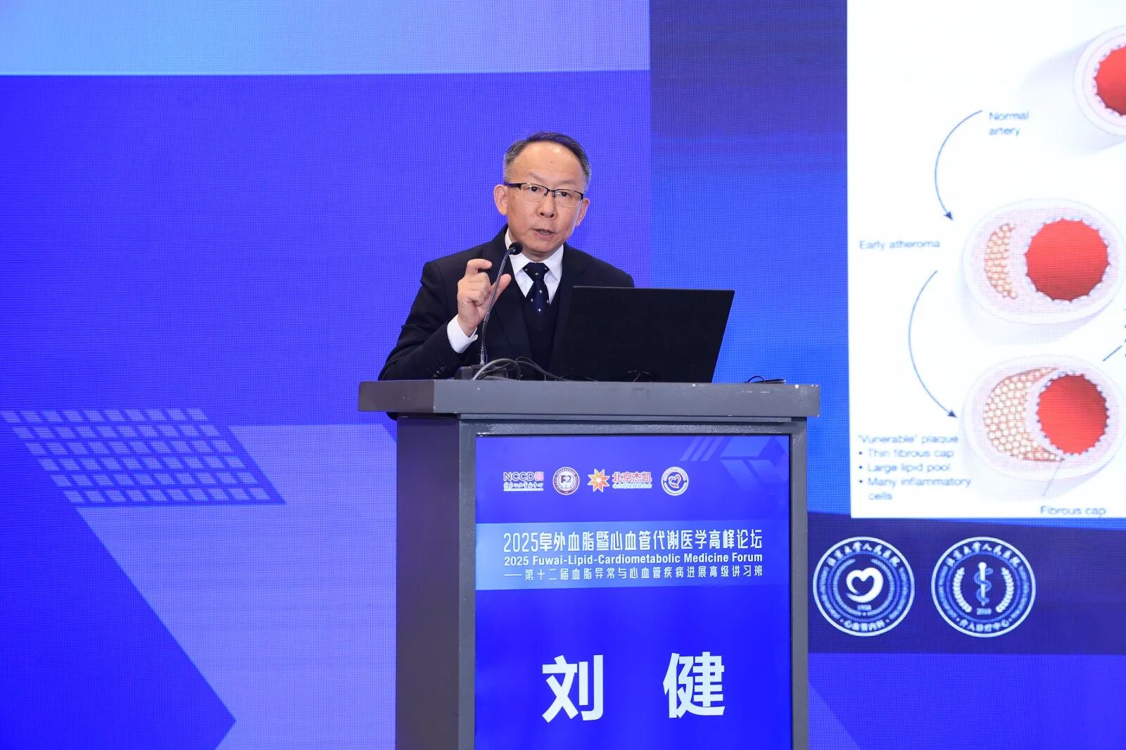 刘健教授：血脂降了，心血管疾病风险为何还在？你的血管里可能燃着一把“慢火”