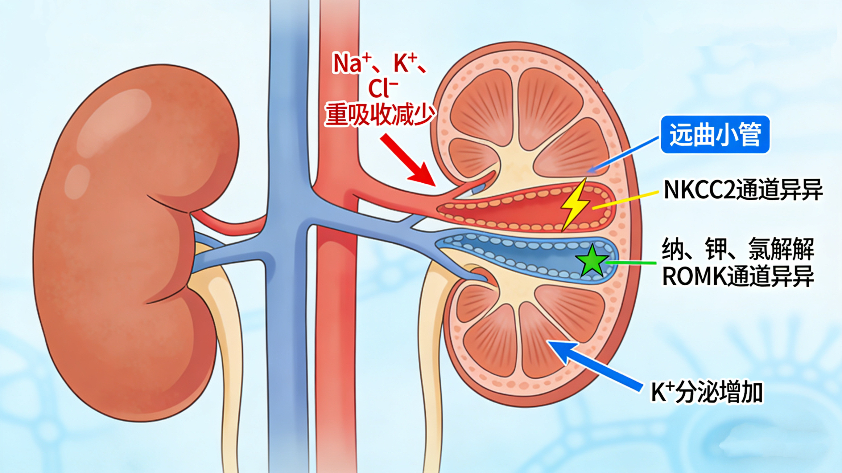 【以例会友】“钾”的悖论：罕见巴特综合征患者缘何陷入高钾危象？