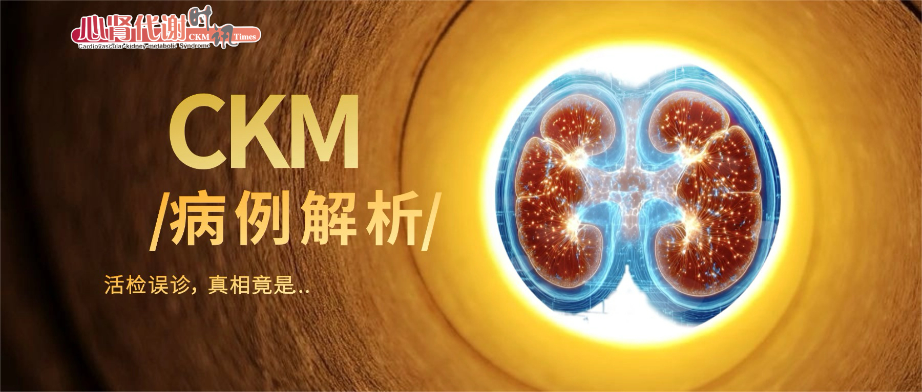 【病例通关Case+】十年肾病治错方向？肾活检误诊，真相竟是代谢性肾病