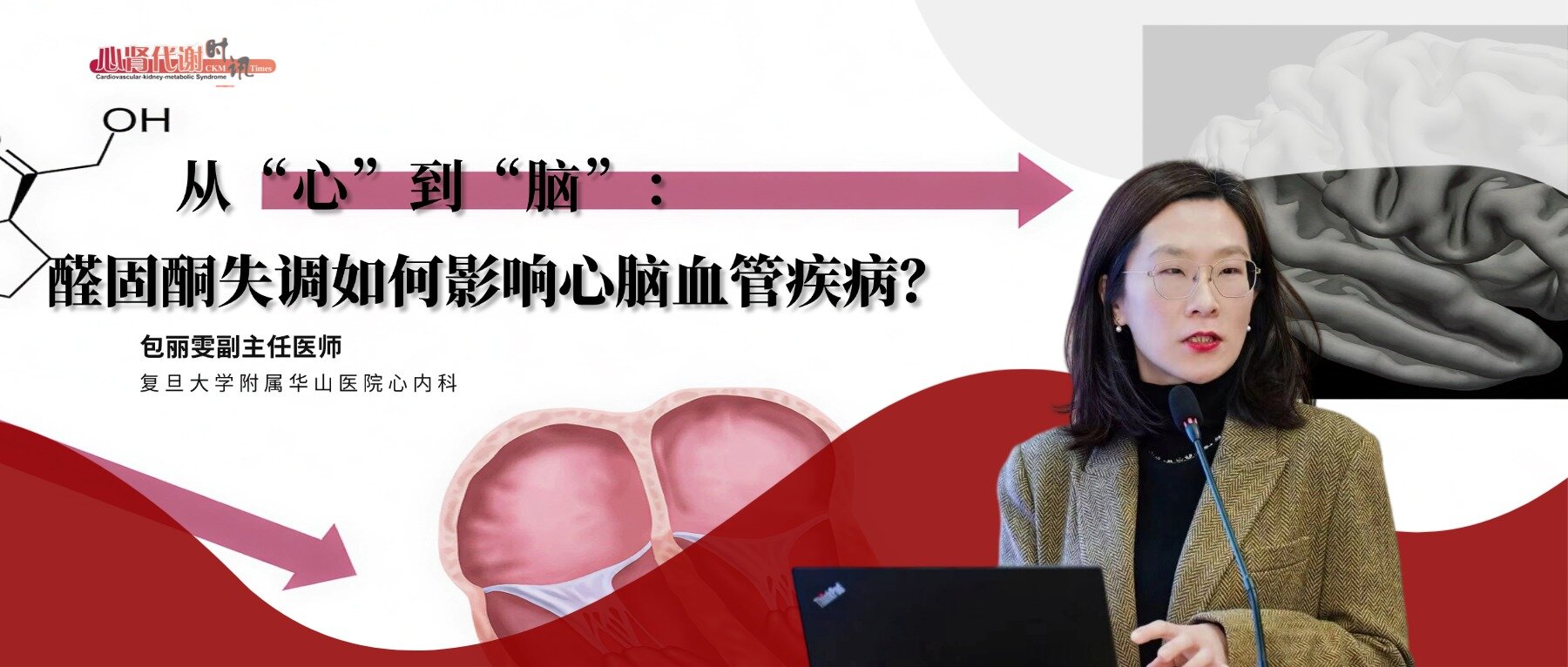 从“心”到“脑”：醛固酮失调如何影响心脑血管疾病？