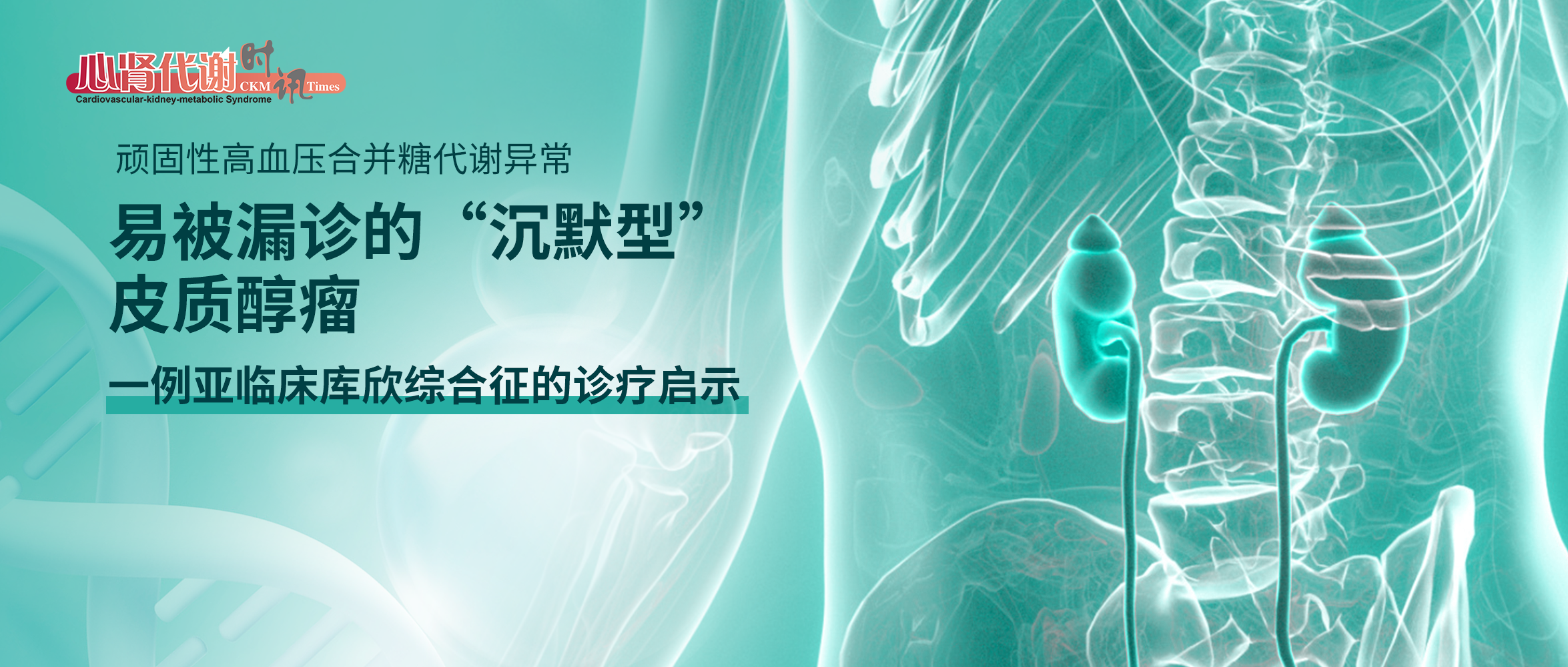顽固性高血压合并糖代谢异常，易被漏诊的“沉默型”皮质醇瘤：一例亚临床库欣综合征的诊疗启示